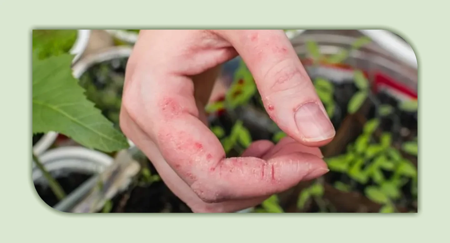 راهکارهایی برای کاهش خطر مسمومیت از گیاهان آپارتمانی